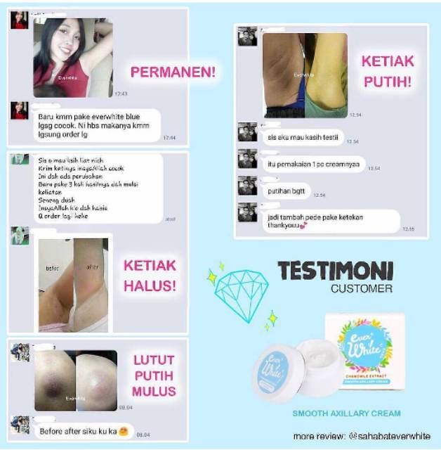 EVERWHITE SMOOTH AXILLARY CREAM - EVER WHITE BLUE. PEMUTIH KETIAK SIKU LUTUT LIPATAN TUBUH