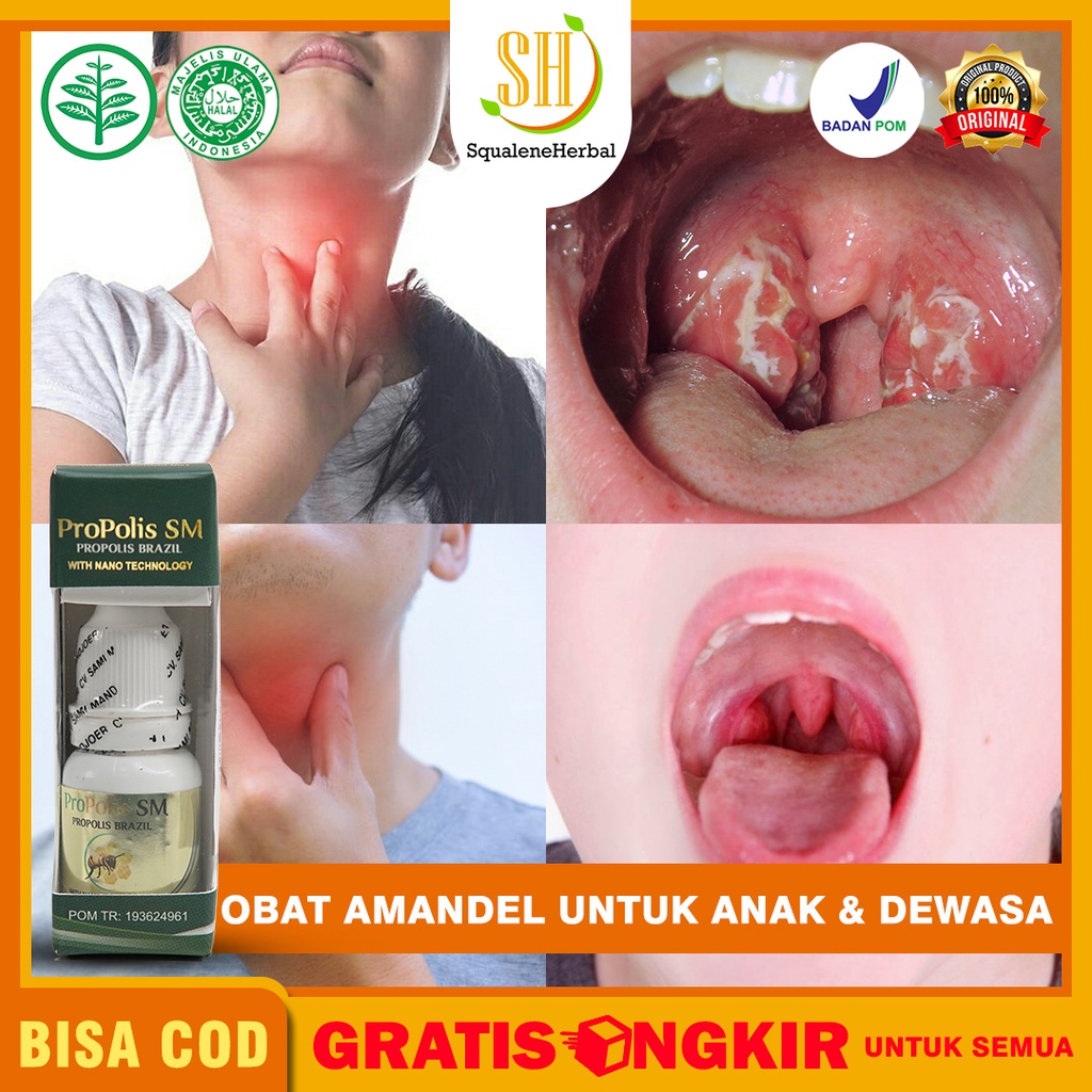 Obat Amandel Untuk Anak dan Dewasa - Amandel Bengkak - Susah Menelan - Amandel Parah - Atasi Dengan 