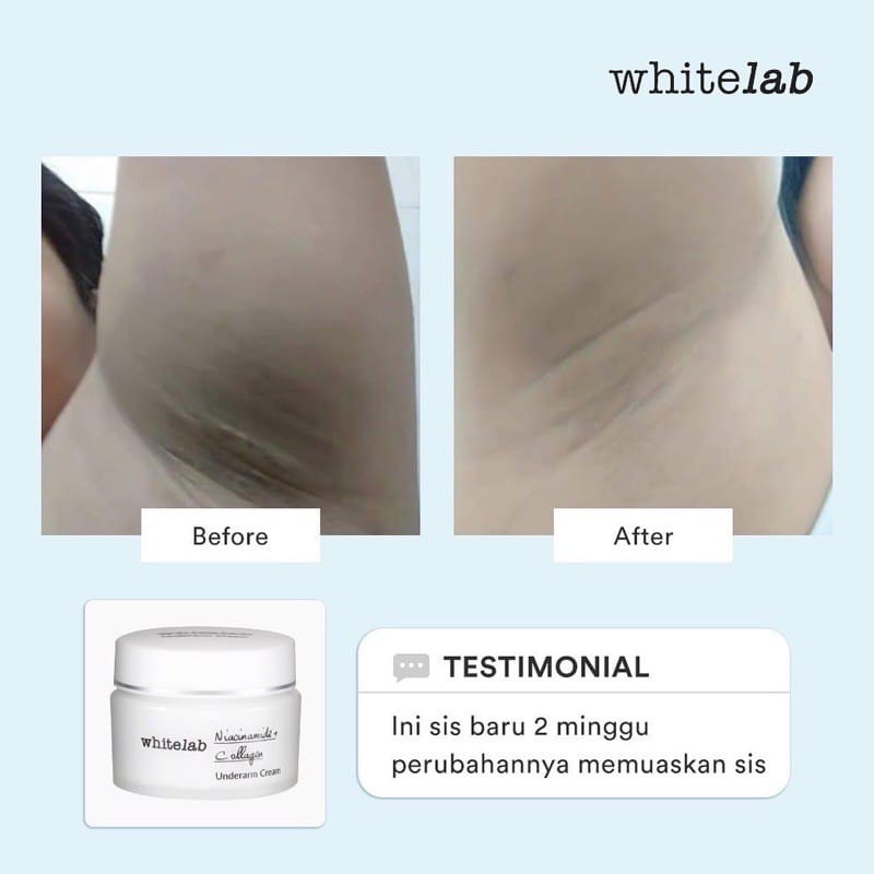 WHITELAB Underarm Cream 20g