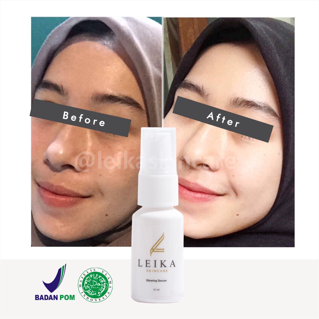 Wow! Serum Glowing Pencerah Kulit Wajah Serum Pencerah Wajah Kusam Murah Ampuh Serum Pencerah Wajah Berminyak Glowing Serum Leika Skincare 12ml korea cepat Asli BPOM dan Halal