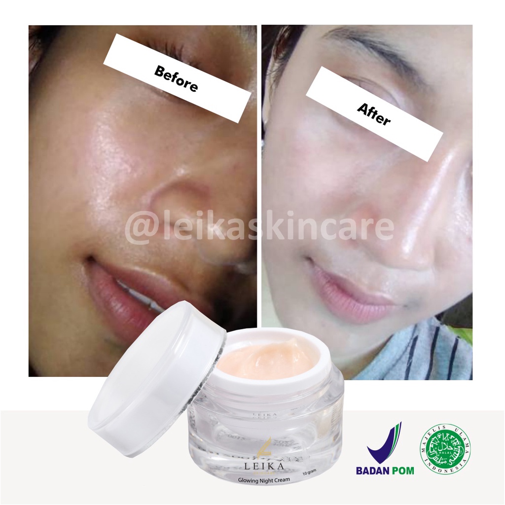 Ampuh! Krim untuk Mengurangi Minyak di Kulit Wajah Cream Menghilangkan Muka Berminyak Krim Muka untuk Kulit Berminyak Ampuh Penghilang Wajah Berminyak Glowing Night Cream Leika Skincare 10gr Resmi BPOM dan Halal