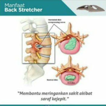 Luvina Back Stretcher / Alat Terapi Pinggang, Saraf Terjepit