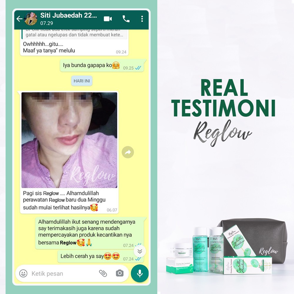 Paket Cream Dan Toner & MicellarWater REGLOW Utk menghilangkan Flek Jerawat Kerutan-6