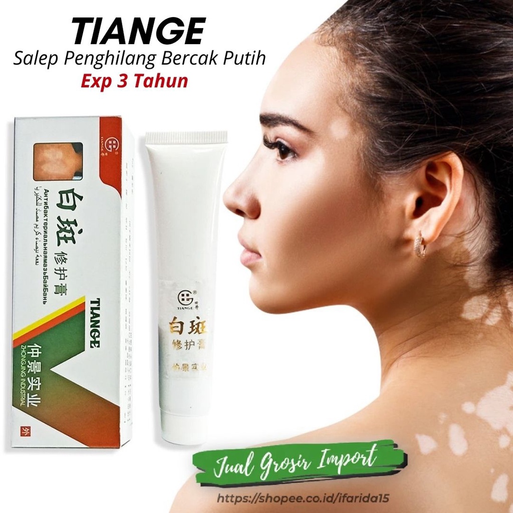 Vitiligo Cream Salep Obat Kulit Bercak Putih Belang White Spots ORI