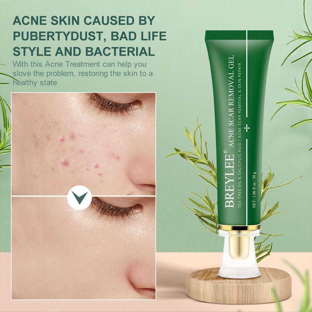 Acne Scar Removal Gel Penghilang Bekas Luka Jerawat Bintik-Bintik Pigmentasi Perawatan Kulit