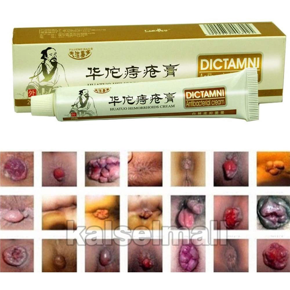 Dictamni HuaTuo 100% ORIGINAL Obat Luar Cream Salep Wasir Ambien AMPUH AMAN TANPA EFEK SAMPING Ambeyen Ambeien Ambian Hemorrhoids Salap Herbal Cina Asli Ambeien Akut Hua Tuo Diktamani Dictamini Washir China OC8