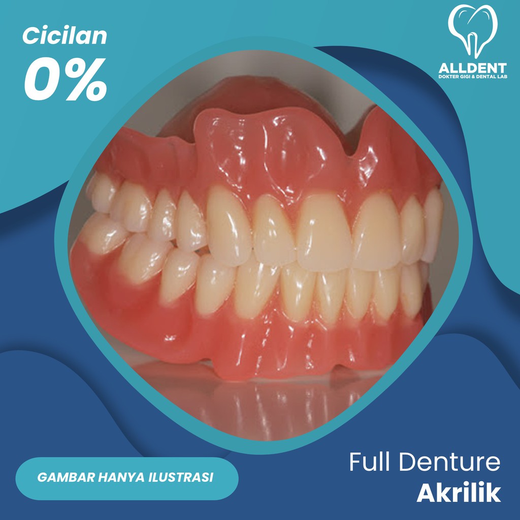 Gigi Palsu Lepasan 1 Rahang - Full Denture Akrilik