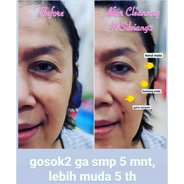 SILVIANG 3 READY STOK / ALAT FACIAL DI RUMAH / SETRIKA WAJAH (ART. 1772)