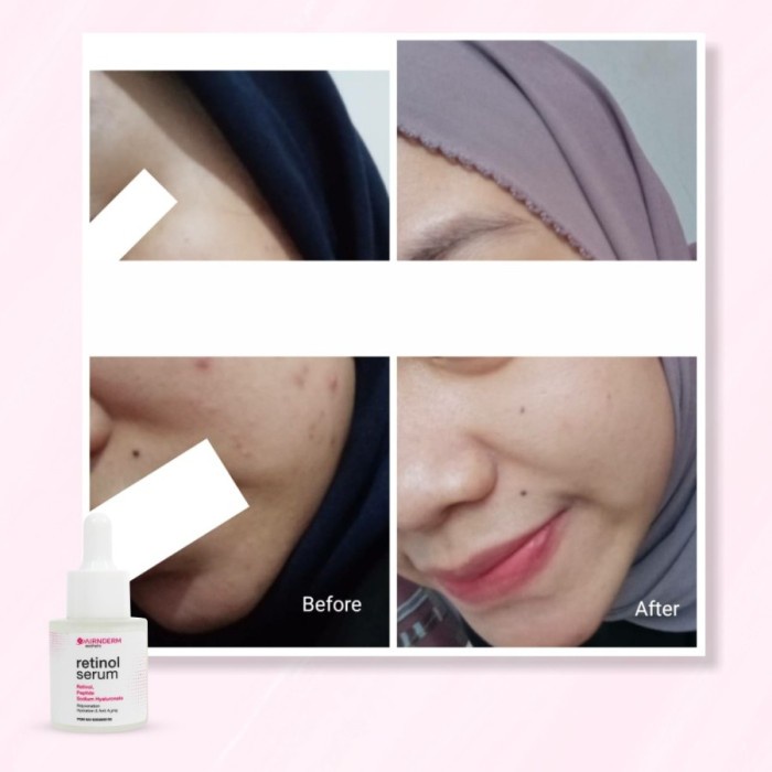 AIRIN Airnderm Retinol serum - BPOM