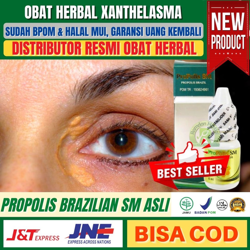 Obat Xanthelasma Di Apotik | Penghilang Alami Xanthelasma | Plak Kuning Di Kelopak Mata | Propolis S