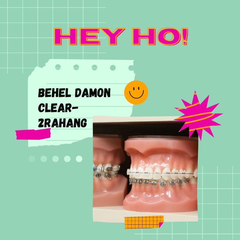 Behel Damon Clear - 2Rahang