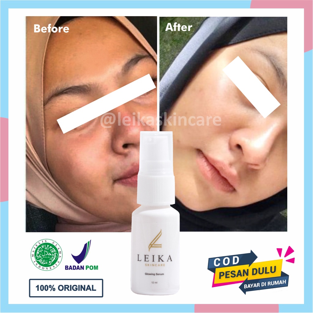ASLI Serum Pencerah Kulit Wajah Hasil Permanen Serum Pencerah Wajah Glowing BPOM Halal MUI Serum Pen