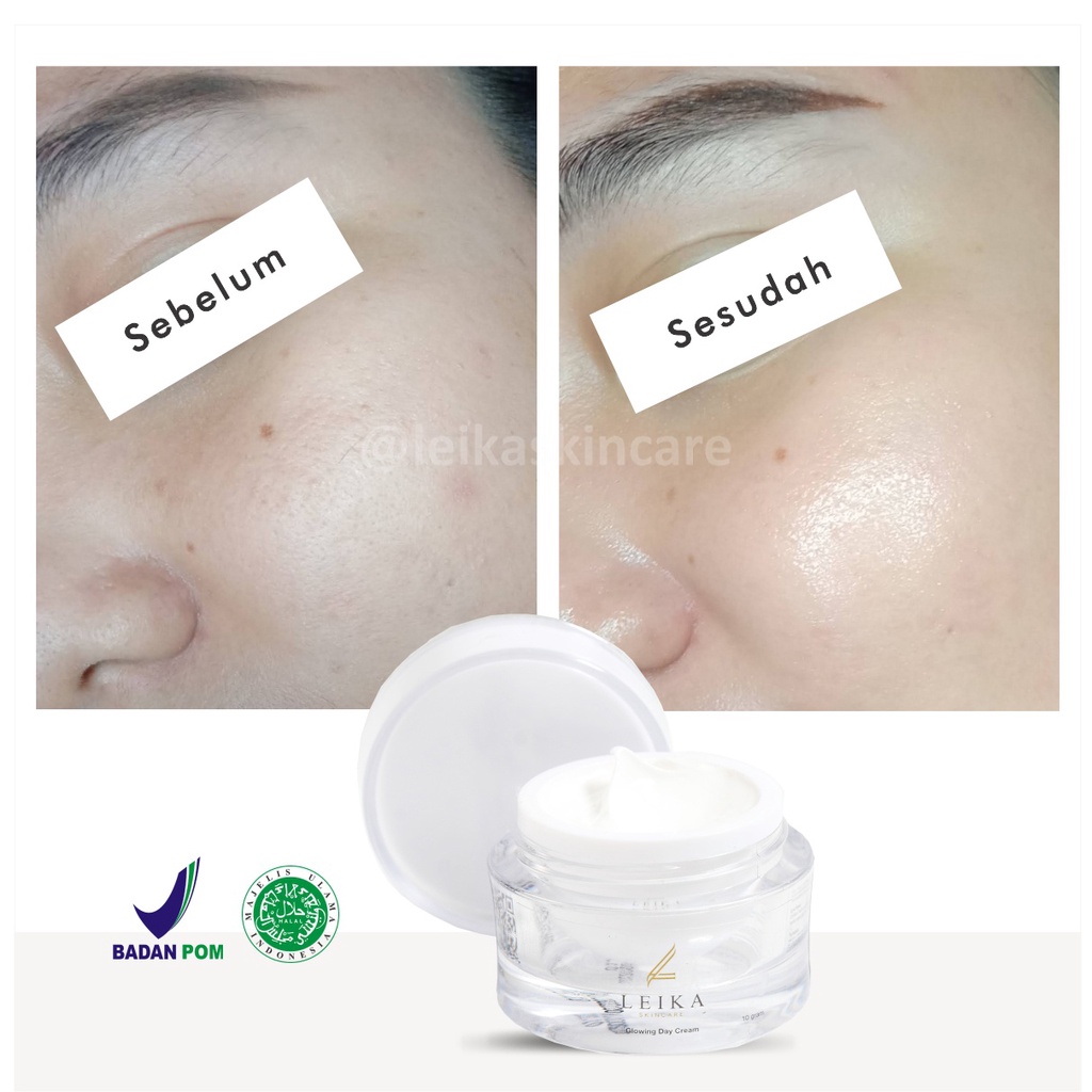 Menakjubkan! Krim Pelembab Wajah Kering dan Berminyak [Ampuh!] Cream Pelembab Wajah Jerawat jadi Glowing / Glowing Day Cream Leika Skincare 10gr Cream Pelembab Glowing Aman Ampuh Original BPOM Halal MUI