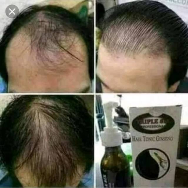 DIJAMIN ASLI Hair Tonic Ginseng Penumbuh Rambut Botak