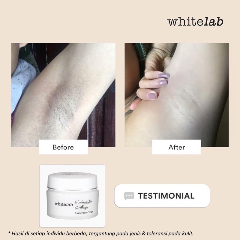 WHITELAB Brightening | Acne SERIES ( Facial Wash, Toner, Serum, Day Night Cream, Underarm, Acne Cream, Eye Cream, Whitelab Mugwort Masker, C dose, A dose, Ph Cleanser Whitelab)