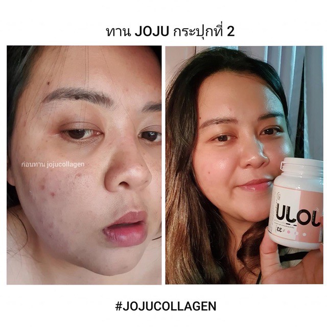 Joju Collagen Original Suplemen Pemutih Kulit Asli Import Minuman Menghilangkan Jerawat Memutihkan Indonesia