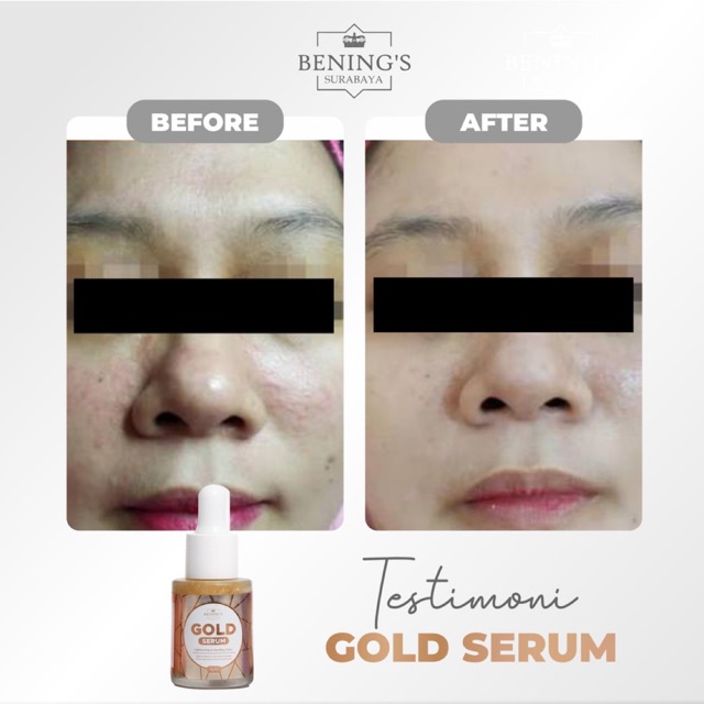 BENING'S SERUM GOLD | MENCERAHKAN, MELEMBABKAN &amp; MERATAKAN WARNA KULIT I FREE GIFT SIAP KIRIM KE SELURUH INDONESIA