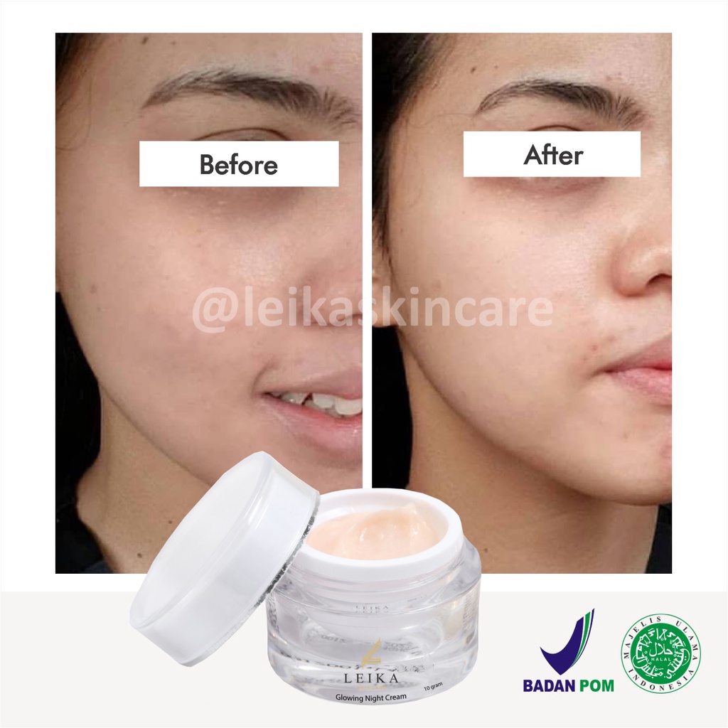 Ampuh! Pelembab Wajah Bikin Kulit Wajah Glowing dan Putih Krim Pelembab Wajah Kering Berjerawat Ampuh Glowing Night Cream Leika Skincare Cream Wajah Glowing Aman BPOM Krim Pe mutih Wajah bpom Glowing Cream Pe mutih Wajah Glowing  BPOM Asli 100% HALAL MUI