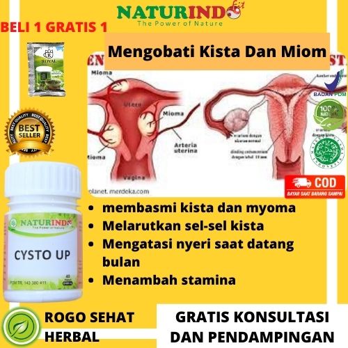 Obat Kista Miom Ovarium Obat Herbal Kista Bartholin Obat Penyakit Rahim Obat Cista Cysta Obat Miom M