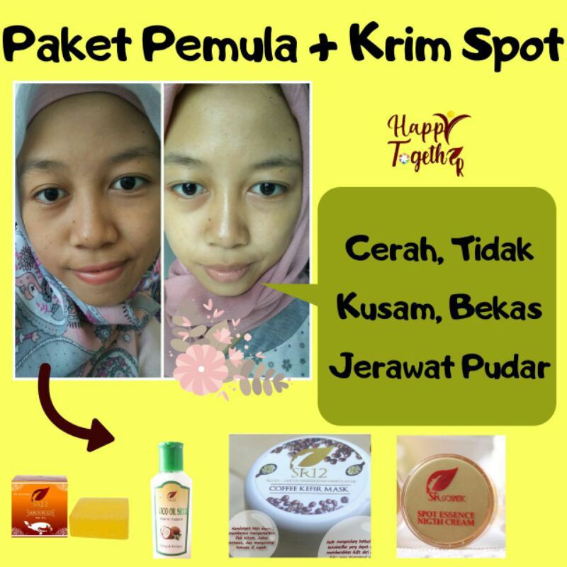 (COD)SPOT ESSENCE SR12 - MENGHILANGKAN FLEK HITAM DIWAJAH - KRIM WAJAH/ KRIM PEMUTIH BPOM/ PENGHILANG FLEK WAJAH/ WHITENING CREAM