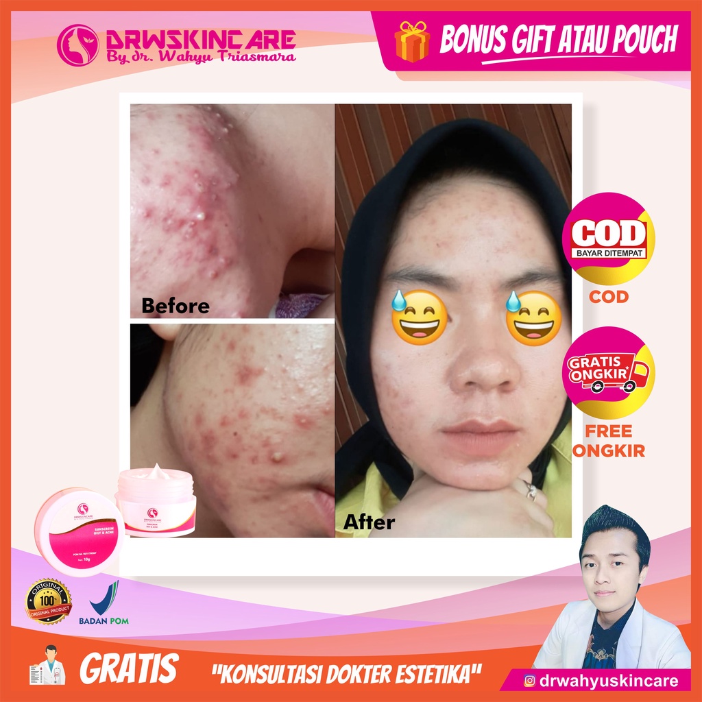 Sunscreen / Day Cream Acne DRW SKINCARE Cream Siang Untuk Kulit Berminyak dan Berjerawat DRW SKINCAR