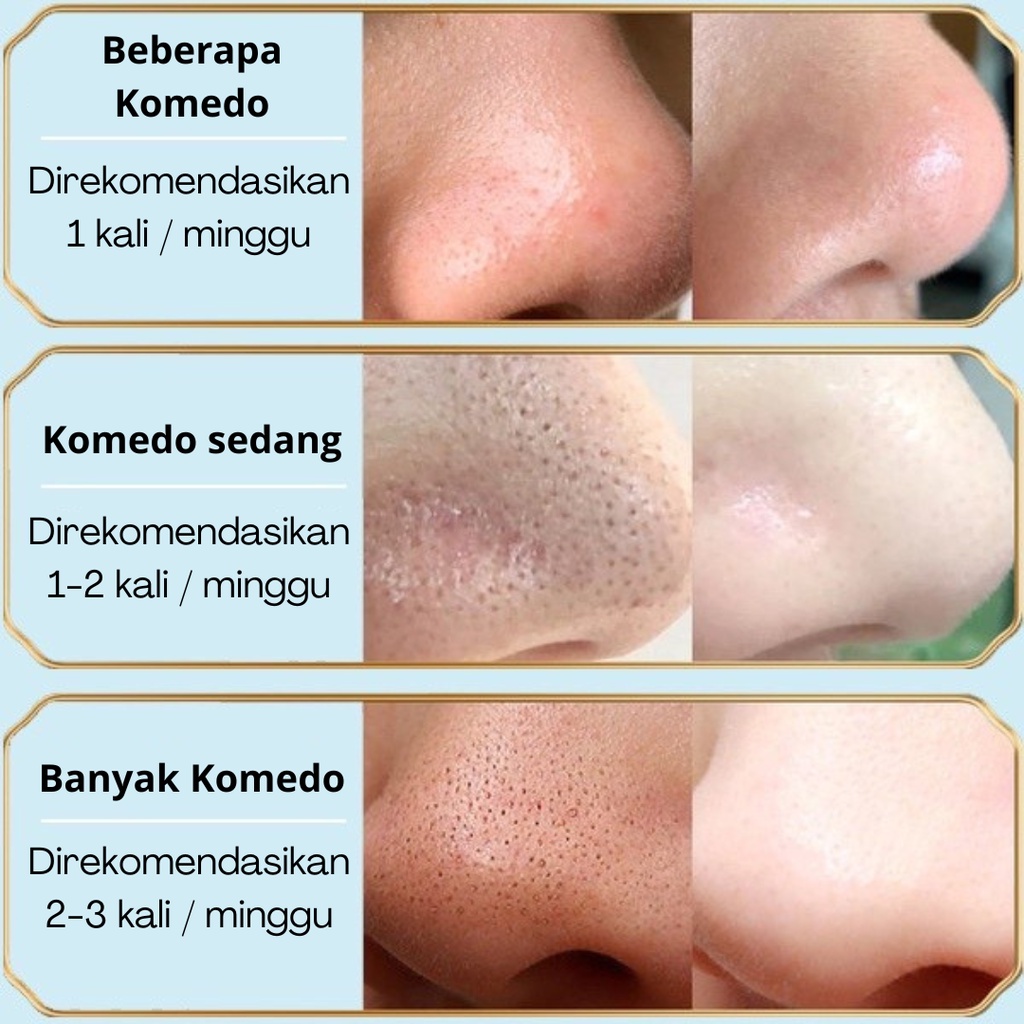 Girlpal Charcoal Blackhead Remover Peel Off Mask Masker Wajah Pembersih Komedo Hidung Wajah Jerawat Beruntusan Mengecilkan Poripori Wajah Bpom