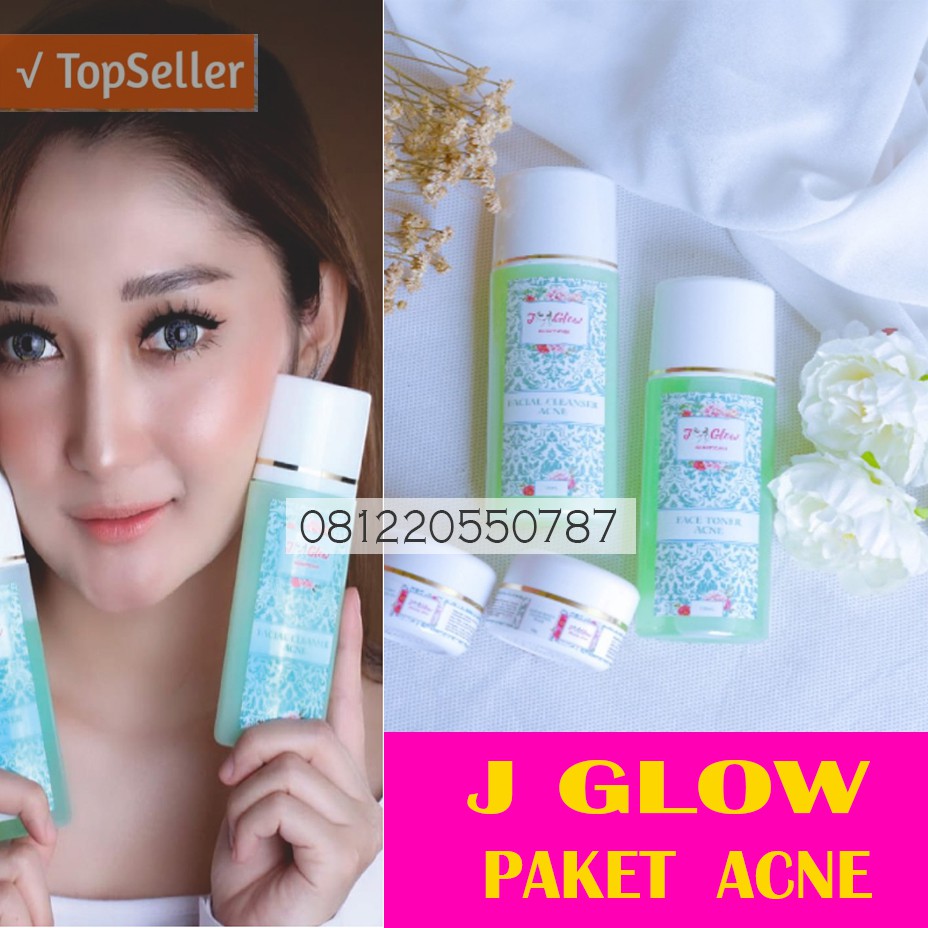 Jglow J Glow Acne Whitening Paket Skincare Untuk Kulit Berminyak Dan Berjerawat Shopee Indonesia