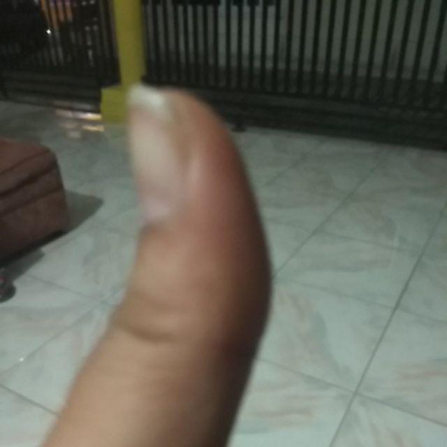 Proclin Penghilang Noda 400ml Botol