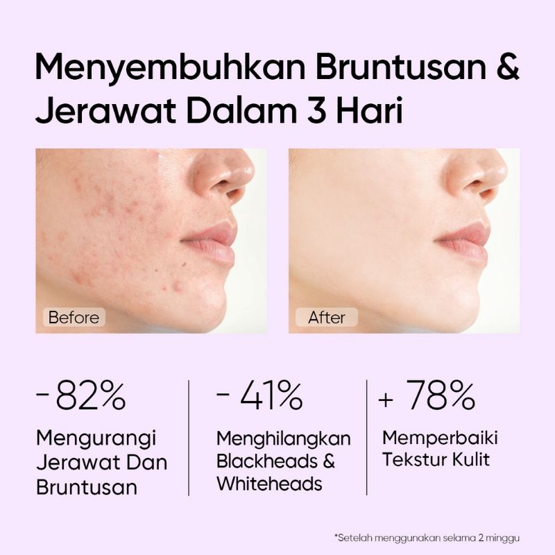 (GOSEND/COD) SKINTIFIC 5% AHA BHA PHA EXFOLIATING TONER SKIN EKSFOLIASI GLOW AND SMOOTH WITH NIACINAMIDE