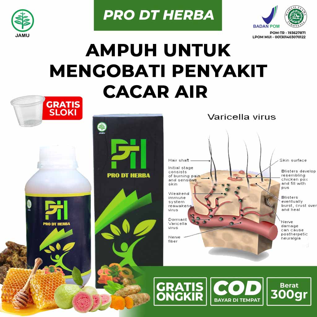 Obat Cacar Air Paling Ampuh, Cacar Monyet, Cacar Air Anak, Cacar Api, Cacar Air Dewasa Herbal Pro DT