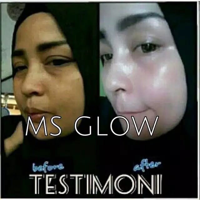 ✿ELYSABETHME✿ Ms glow paket whitening basic pemutih paket perawatan wajah (luminous , anti aging , acne , whitening)