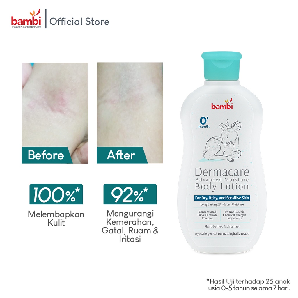 Bambi Baby Dermacare Advance Moisture Body Lotion 200ml | Lotion Pelembab Bayi Anak Khusu Kulit Atopic / Eczema / Eksim | Lotion Triple Ceramide