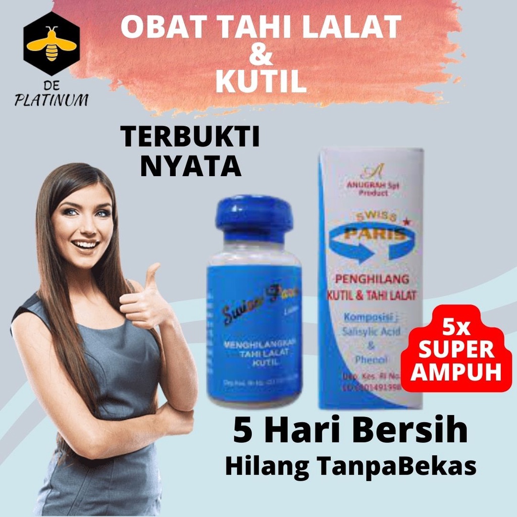 ORIGINAL Lotion Swiss Paris Obat Penghilang Kutil & Tahi Lalat Obat Kutil dan Tahi Lalat obat kutil
