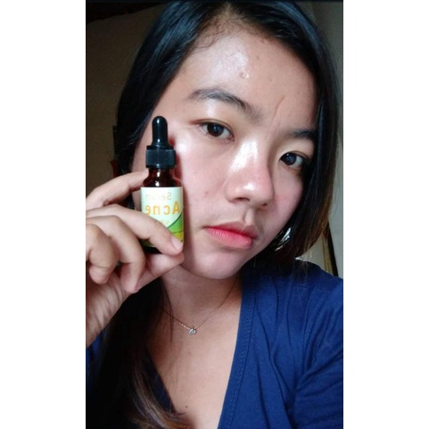 SERUM GLOWING PELICIN WAJAH TERLARIS NIACIAMIDE AMPUH SERUM PELICIN WAJAH BPOM