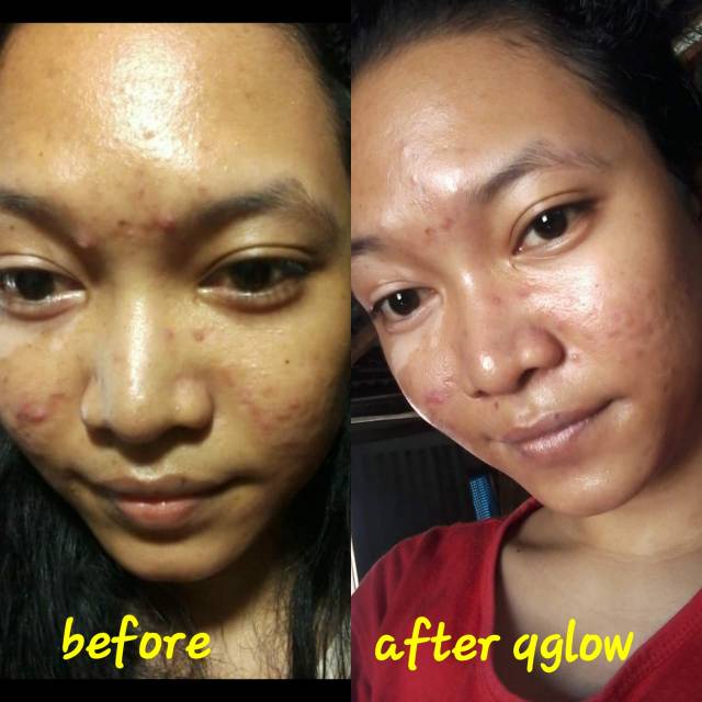 Q GLOW SKINCARE ORIGINAL BPOM HALAL ALL PAKET DAN ECER