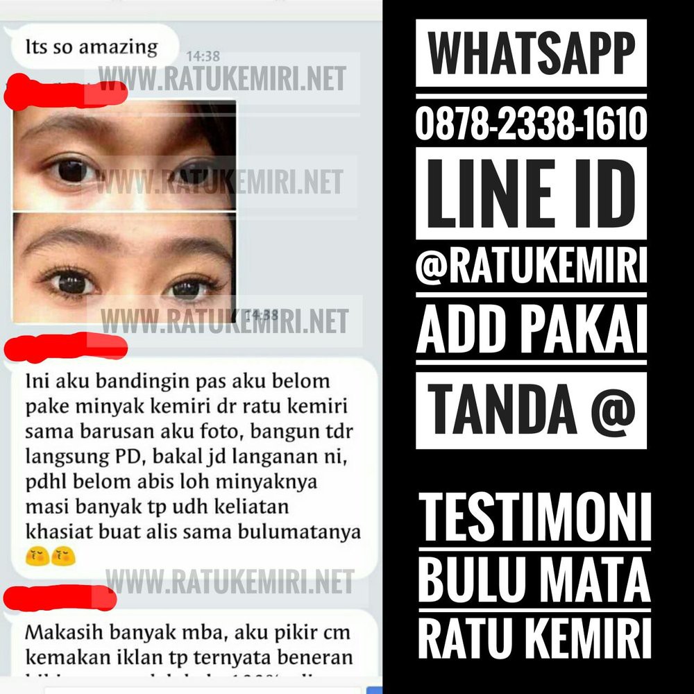 Jual Ratu Kemiri Penyubur Rambut Rontok Dan Pelebat Alis Mata Alami Limited Shopee Indonesia