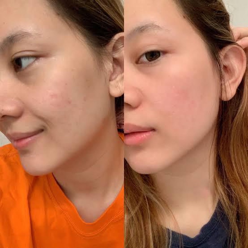 Glutaindo Colaskin - Suplemen Pemutih Kulit Kapsul Pemutih Seluruh Badan
