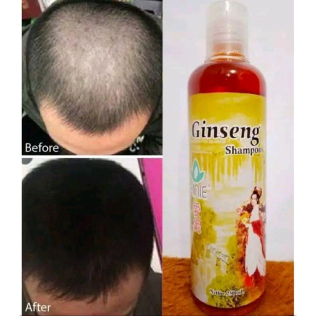 [BISA COD] Shampo Ginseng Penumbuh Rambut Obat Botak Shampo Anti Rontok Vitamin Rambut Hair Care Anti Ketombe