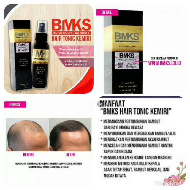 BMKS HAIR TONIC KEMIRI ORIGINAL BPOM MENUMBUHKAN &amp; MENYUBURKAN RAMBUT