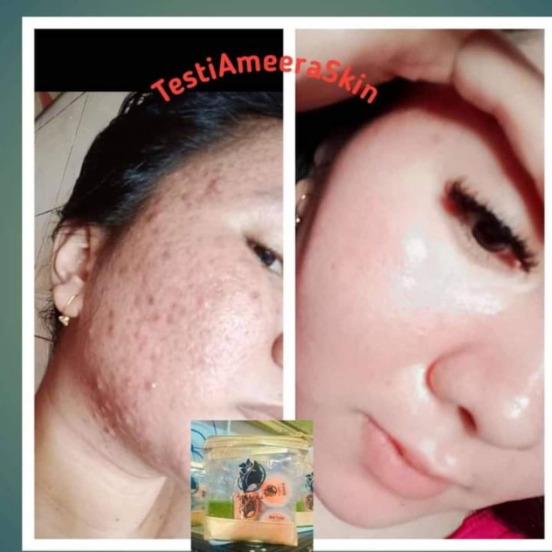 Ameera beauty skin by Mega maulida