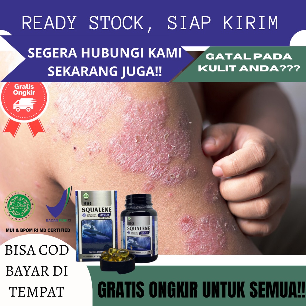 Obat Gatal Kulit Paling Banyak di Cari, Obat Gatal gatal Pada Kulit, Gatal Kulit Anak, Gatal Kulit A