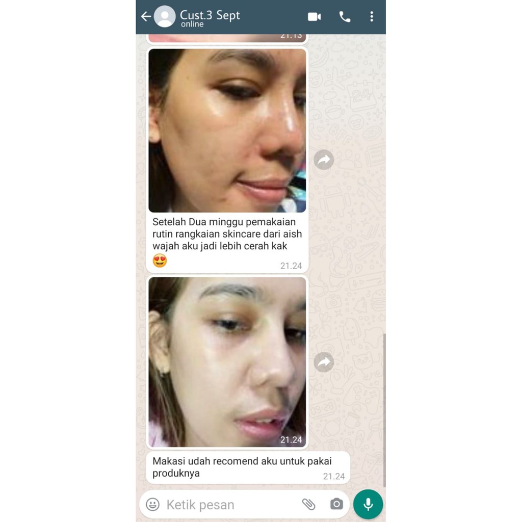 AISH SKINCARE - AISH FACIAL WASH/TONER AISH/SERUM AISH KOREA/CREAM AISH/PAKET SKINCARE AISH ORIGINAL