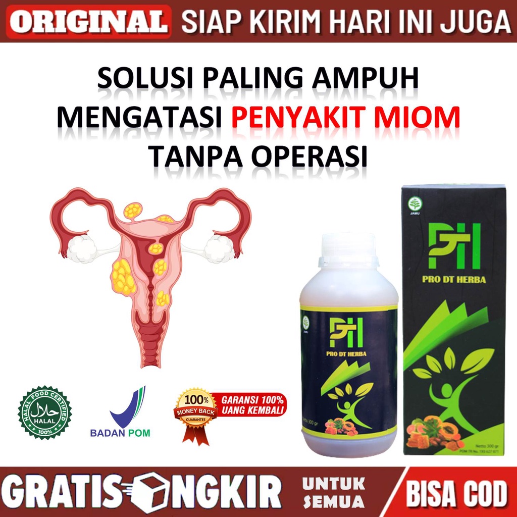 Obat Miom Alami - Obat Miom Dan Promil - Obat Miom Dan Kista - Obat Miom Herbal - Obat Miom Uterus -