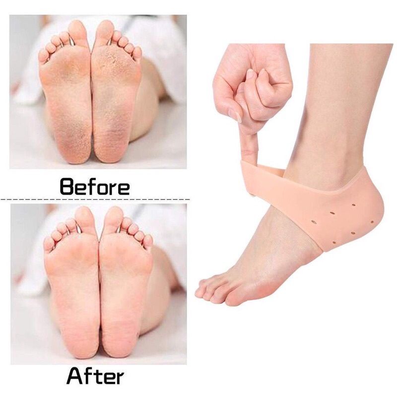 Silikon Pelindung Tumit anti pecah2 / Insole Silikon Elastis