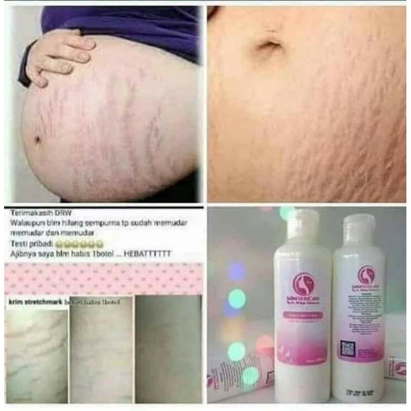 DRW SKINCARE BPOM 100% ORIGINAL_Stretchmark Cream Drw Skincare