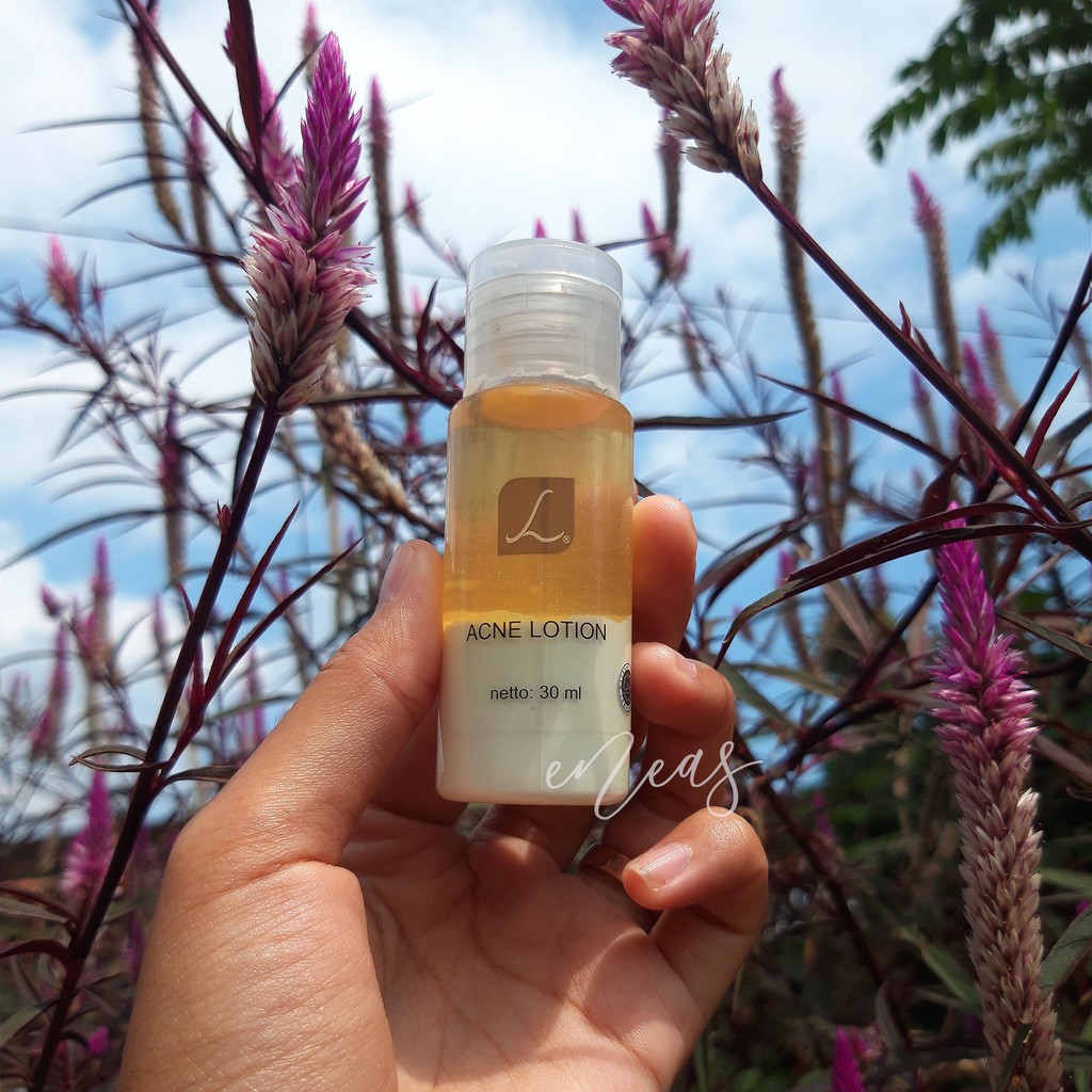Acne Lotion Larissa