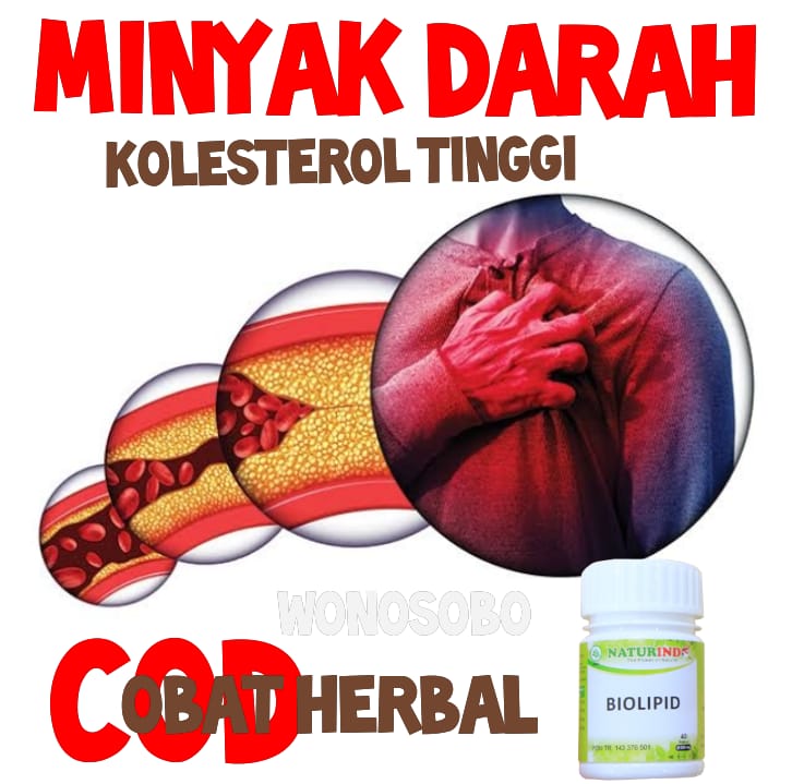 Obat Herbal Kolestrol Kolesterol Lemak Darah Kolestrol Ldl Hdl Kolestrol Tlegeserid Naturindo Cod Shopee Indonesia