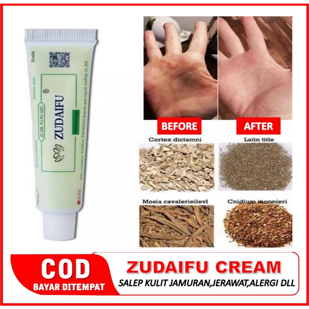 Salep Obat Gatal Eksim Kering Basah Menahun Paling Ampuh Kurap Panu Selangkangan Jamur Gatel Kulit /