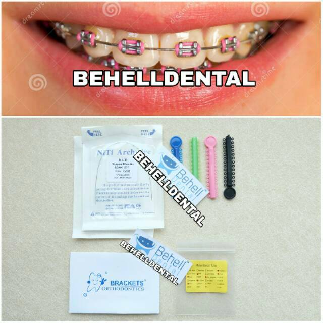 Paket Behel Gigi Permanen Murah Orthodontic Amplop | perawatan perbaikan . Kawat braces