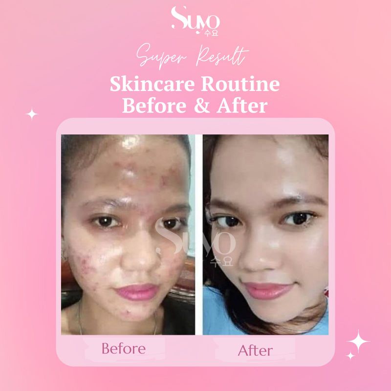 pakt flek suyo skincare